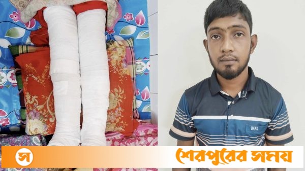 ঝিনাইগাতীতে মা’কে পিটিয়ে পা ভেঙ্গে দেওয়ার অভিযোগে ছেলে গ্রেফতার