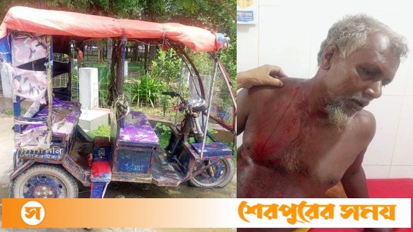 শেরপুরের ঝিনাইগাতীতে অটো ছিনতাইকারী চক্রের ছুরিকাঘাতে চালক আহত